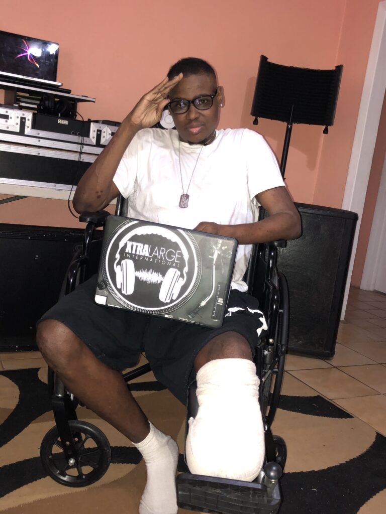 DJ Xtra Large poses with his laptop in his living room. He sits in his wheelchair weeks after half his leg was amputated.